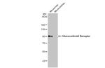 Glucocorticoid receptor (NR3C1) Antibody in Western Blot (WB)