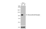 Glucocorticoid receptor (NR3C1) Antibody in Western Blot (WB)