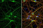 GAD65/GAD67 Antibody in Immunocytochemistry (ICC/IF)