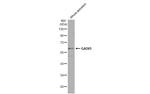 GAD65 Antibody in Western Blot (WB)