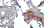 C1 inhibitor Antibody in Immunohistochemistry (Paraffin) (IHC (P))