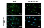 BNIP3L Antibody in Immunocytochemistry (ICC/IF)