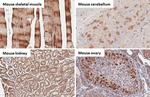 BNIP3L Antibody in Immunohistochemistry (Paraffin) (IHC (P))