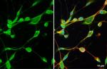 MMP2 Antibody in Immunocytochemistry (ICC/IF)