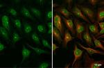 DUT Antibody in Immunocytochemistry (ICC/IF)