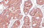 RRM1 Antibody in Immunohistochemistry (Paraffin) (IHC (P))