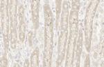 RRM1 Antibody in Immunohistochemistry (Paraffin) (IHC (P))