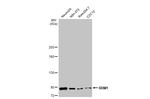 RRM1 Antibody in Western Blot (WB)