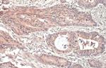 RRM1 Antibody in Immunohistochemistry (Paraffin) (IHC (P))