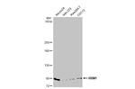 RRM1 Antibody in Western Blot (WB)