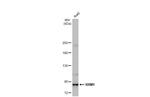 RRM1 Antibody in Western Blot (WB)