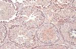 Dicer Antibody in Immunohistochemistry (Paraffin) (IHC (P))