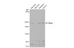 Dicer Antibody in Western Blot (WB)