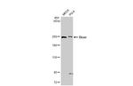 Dicer Antibody in Western Blot (WB)