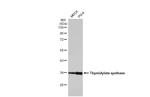 Thymidylate Synthase Antibody in Western Blot (WB)