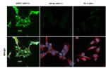 Androgen Receptor (ARv7 Splice Variant) Antibody in Immunocytochemistry (ICC/IF)