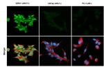 Androgen Receptor (ARv7 Splice Variant) Antibody in Immunocytochemistry (ICC/IF)