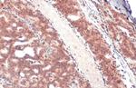 Androgen Receptor (ARv7 Splice Variant) Antibody in Immunohistochemistry (Paraffin) (IHC (P))