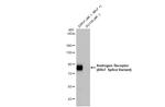 Androgen Receptor (ARv7 Splice Variant) Antibody in Western Blot (WB)