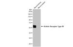 ACVR1B Antibody in Western Blot (WB)