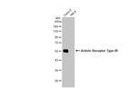 ACVR1B Antibody in Western Blot (WB)