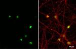 NFIX Antibody in Immunocytochemistry (ICC/IF)