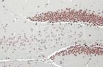 NFIX Antibody in Immunohistochemistry (Paraffin) (IHC (P))