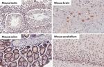 BRD9 Antibody in Immunohistochemistry (Paraffin) (IHC (P))