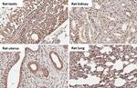 BRD9 Antibody in Immunohistochemistry (Paraffin) (IHC (P))