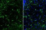 GFAP Antibody in Immunohistochemistry (Frozen) (IHC (F))