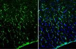 GFAP Antibody in Immunohistochemistry (Frozen) (IHC (F))