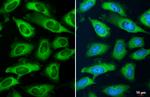 YTHDF2 Antibody in Immunocytochemistry (ICC/IF)