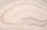 YTHDF2 Antibody in Immunohistochemistry (Paraffin) (IHC (P))