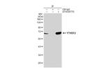 YTHDF2 Antibody in Immunoprecipitation (IP)