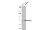 YTHDF2 Antibody in Western Blot (WB)