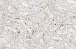 STAR Antibody in Immunohistochemistry (Paraffin) (IHC (P))