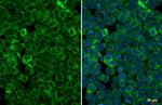 STAR Antibody in Immunocytochemistry (ICC/IF)