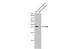 STAR Antibody in Western Blot (WB)