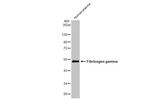 Fibrinogen gamma Antibody in Western Blot (WB)