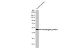 Fibrinogen gamma Antibody in Western Blot (WB)