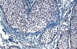 SP1 Antibody in Immunohistochemistry (Paraffin) (IHC (P))