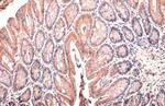 PI3K p85 alpha Antibody in Immunohistochemistry (Paraffin) (IHC (P))