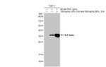 IL-1 beta Antibody in Western Blot (WB)