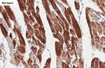 Cardiac Troponin I Antibody in Immunohistochemistry (Paraffin) (IHC (P))