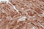 Cardiac Troponin I Antibody in Immunohistochemistry (Paraffin) (IHC (P))