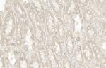 RAB5 Antibody in Immunohistochemistry (Paraffin) (IHC (P))