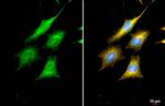 POLB Antibody in Immunocytochemistry (ICC/IF)