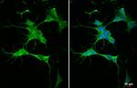 RGS4 Antibody in Immunocytochemistry (ICC/IF)