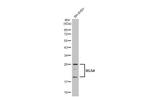 RGS4 Antibody in Western Blot (WB)