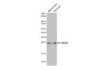 RGS4 Antibody in Western Blot (WB)